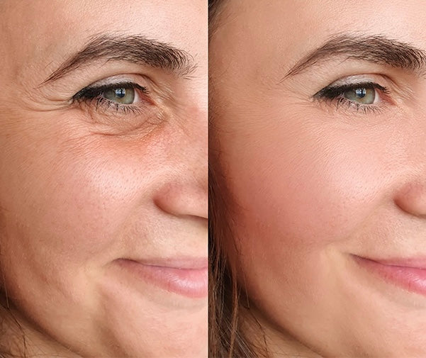 Visibly Rejuvenate in 15 Minutes a Day - The Anti-Wrinkle Secret